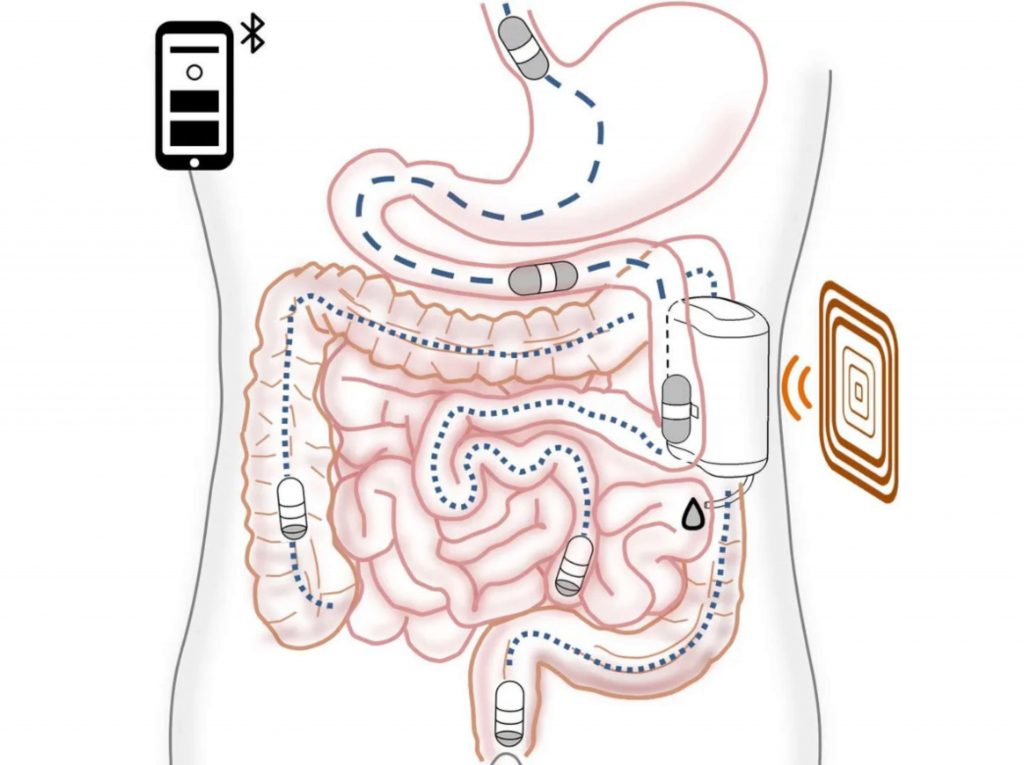 Robótica Médica: Robot ingerible que administra insulina